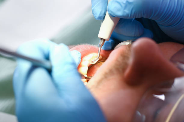 Best Emergency Dentist for Special Needs Patients in Richmond West, FL
